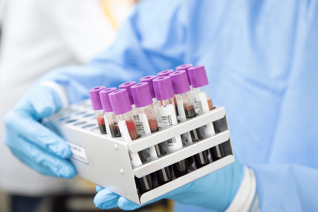 A gloved hand holding a rack of blood sample tubes in a laboratory, representing the new Alzheimer's blood test that can detect biomarkers like p-tau217 for early diagnosis in primary care settings