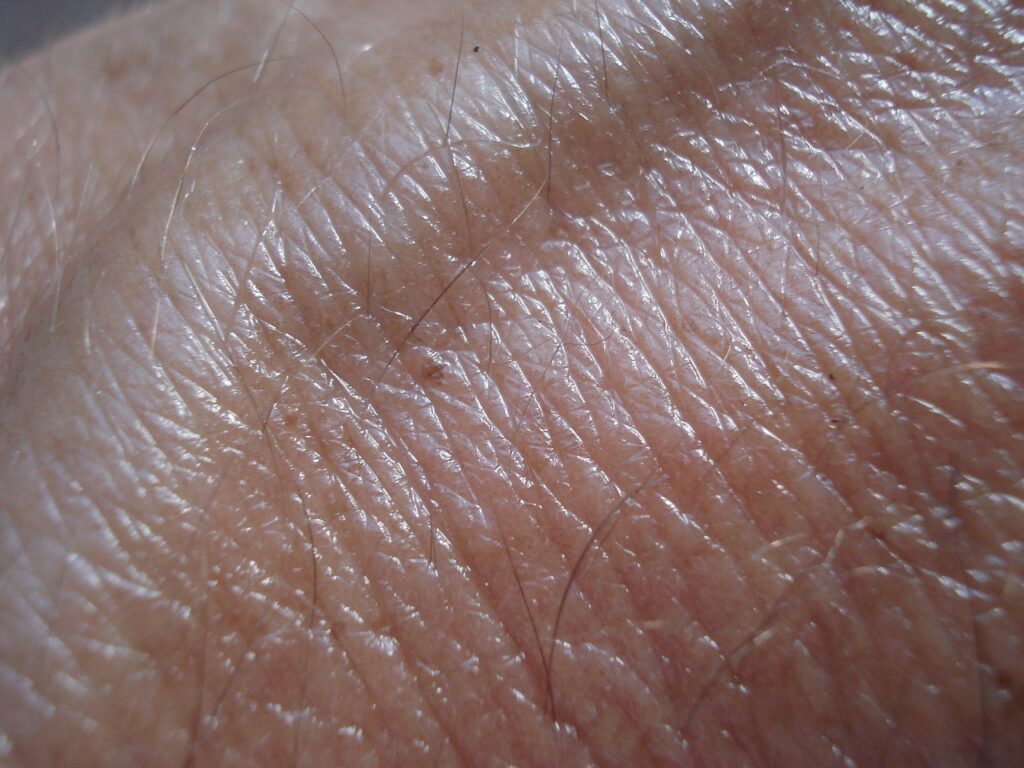 Close-up photograph of human skin with a visible brown spot and veins, representing the subtle skin changes that can be early warning signs of skin cancer, such as non-healing sores, scaly patches, or the ugly duckling mole sign.