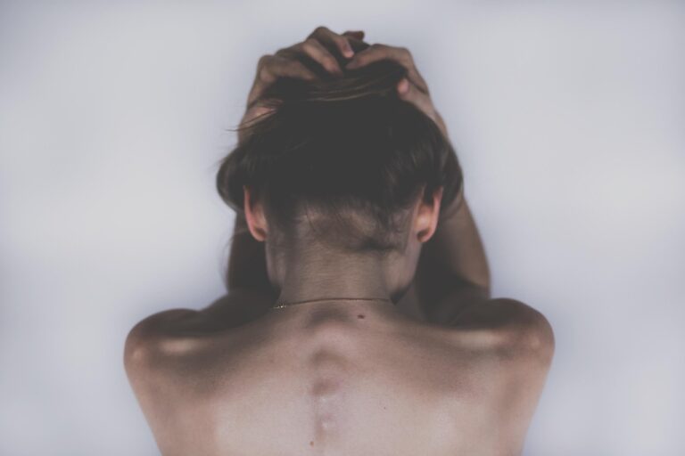 strokes in young adults